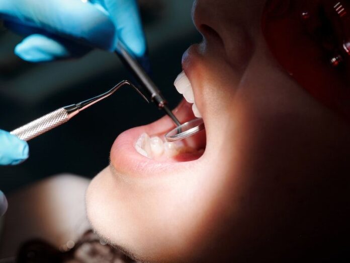 Teeth Whitening At Dentist